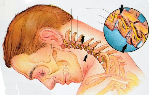 La estructura de las vértebras cervicales