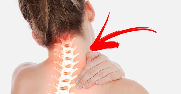 dolor de cuello por qué y qué hacer