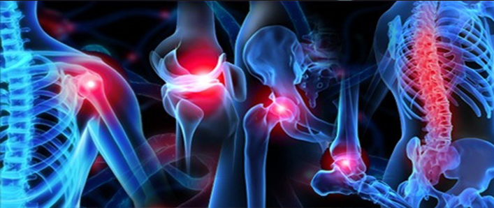 Daño articular